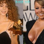 Mariah Carey after breast augmentation