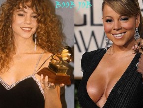 Mariah Carey after breast augmentation