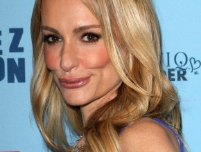 Taylor Armstrong plastic surgery