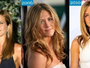 Jennifer Aniston before and after plastic surgery