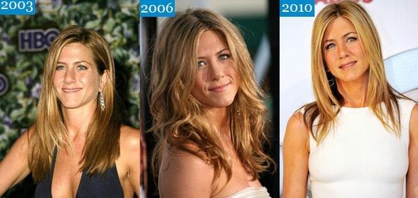 Jennifer Aniston before and after plastic surgery