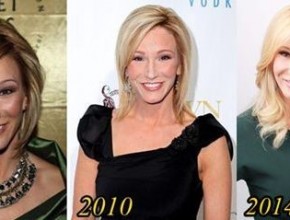 Paula White before and after plastic surgery