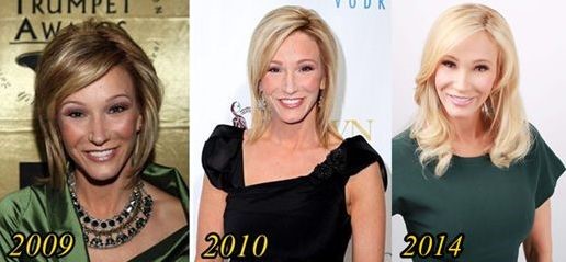 Paula White before and after plastic surgery