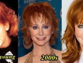 Reba McEntire before and after plastic surgery