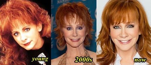 Reba McEntire before and after plastic surgery