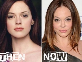 Rose McGowan before and after cosmetic procedures