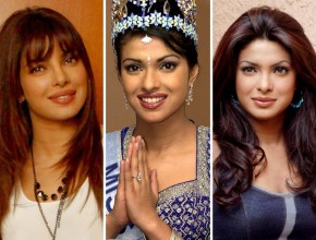 Priyanka Chopra before and after plastic surgery