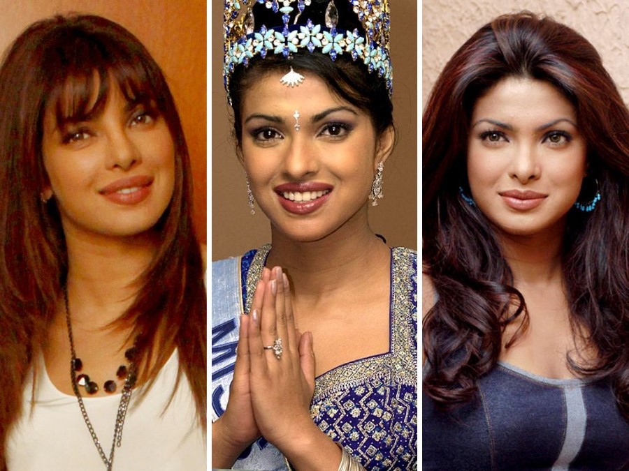 Priyanka Chopra before and after plastic surgery