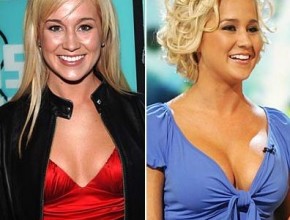 Kellie Pickler before and after breast augmentation