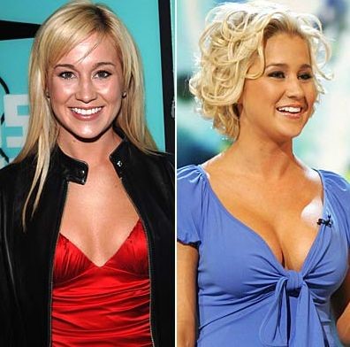 Kellie Pickler before and after breast augmentation