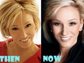 Paula White before and after plastic surgery