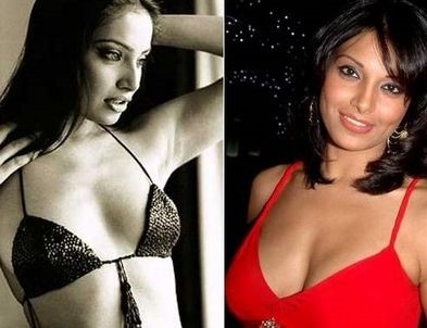 Bipasha Basu before and after plastic surgery