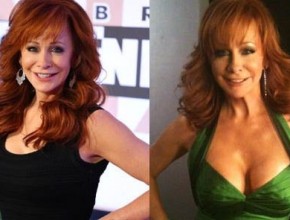 Reba McEntire before and after plastic surgery breast lift