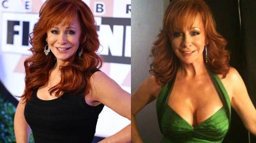 Reba McEntire before and after plastic surgery breast lift