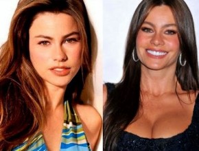 Sofia Vergara before and after plastic surgery