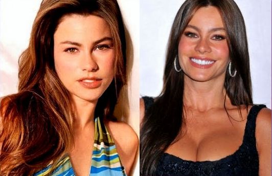 Sofia Vergara before and after plastic surgery