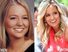 Emily Maynard nose job