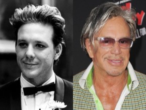 Mickey Rourke plastic surgery