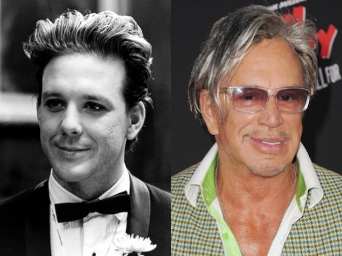 Mickey Rourke plastic surgery