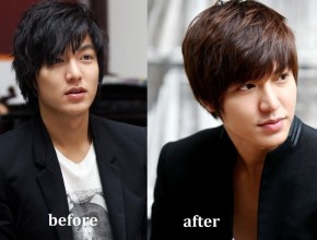 Lee Min Ho before and after plastic surgery