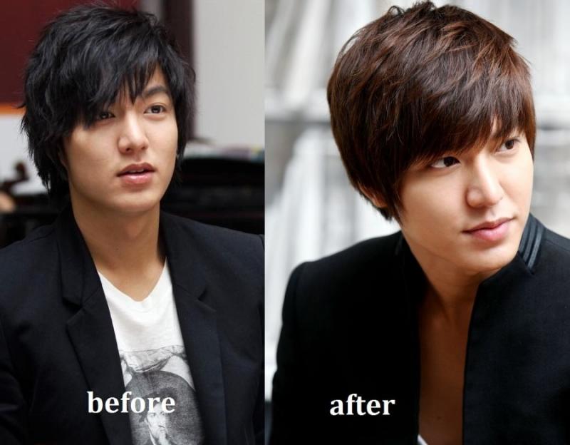 Lee Min Ho before and after plastic surgery