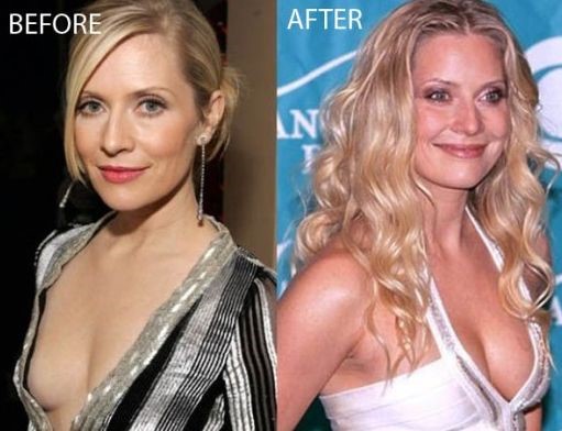 Emily Procter plastic surgery.