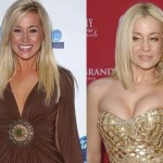 Kellie Pickler before and after plastic surgery