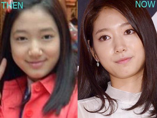 Park Shin Hye before and after plastic surgery.