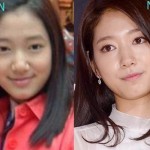 Park Shin Hye before and after cosmetic procedures