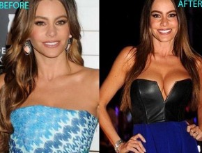 Sofia Vergara before and after breast augmentation