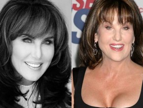 Robin McGraw before and after plastic surgery