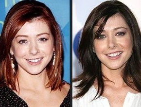 Alyson Hannigan before and after plastic surgery