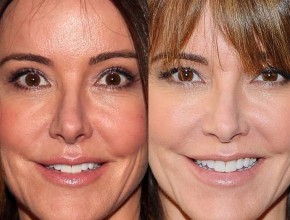 Christa Miller before and after plastic surgery