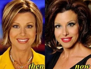 Dominique Sachse before and after plastic surgery