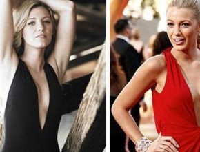 Blake Lively before and after breast augmentation