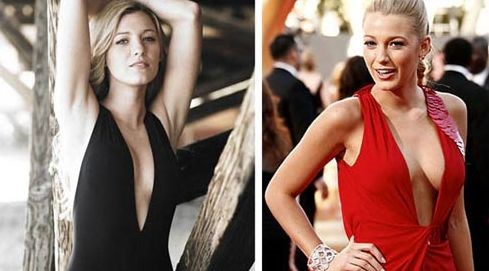 Blake Lively before and after breast augmentation