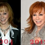 Reba McEntire before and after plastic surgery