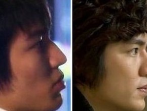 Lee Min Ho before and after nose job