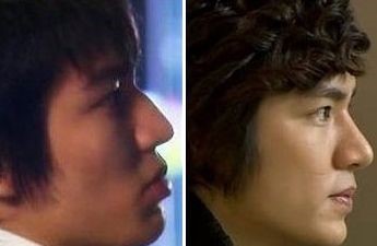 Lee Min Ho before and after nose job