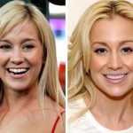 Kellie Pickler before and after plastic surgery