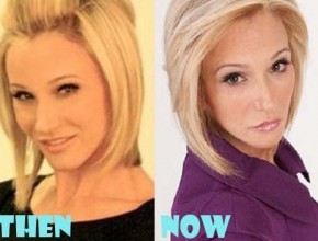 Paula White before and after plastic surgery