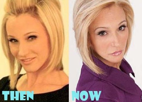 Paula White before and after plastic surgery