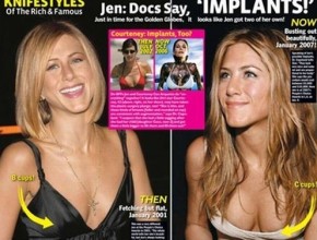 Jennifer Aniston before and after breast augmentation