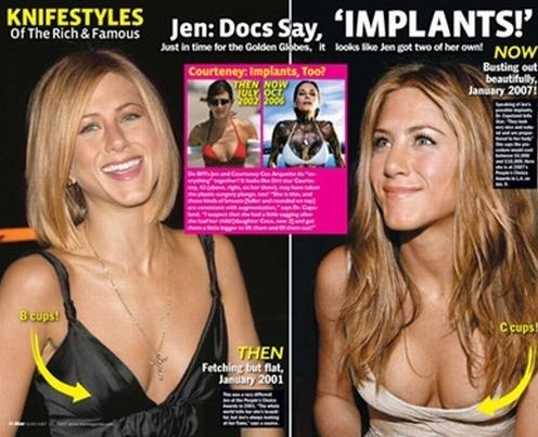 Jennifer Aniston before and after breast augmentation