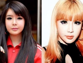 Park Bom before and after cosmetic procedures