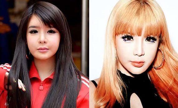 Park Bom before and after cosmetic procedures.