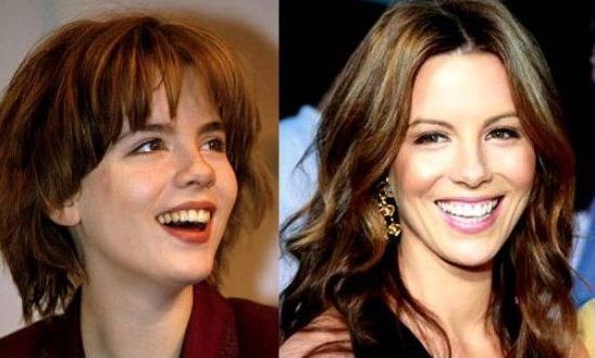 Kate Beckinsale before and after nose job