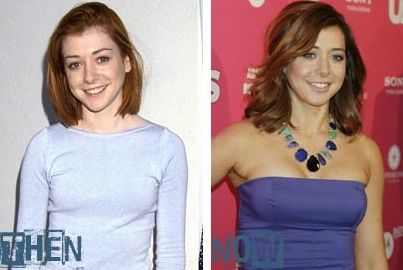 Alyson Hannigan before and after breast augmentation