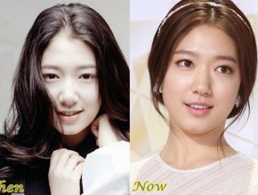 Park Shin Hye before and after plastic surgery