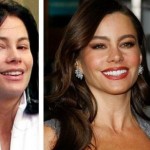 Sofia Vergara before and after cosmetic procedures